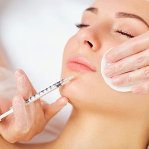 smile line fillers for youthful smile