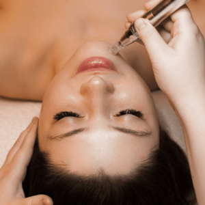 woman having rf microneedling