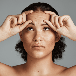 woman with facial wrinkles treatment